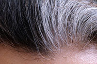 What gray hair says about your health